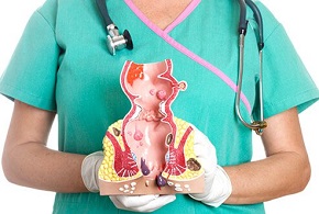 A doctor holds a model of the human rectum showing internal and external hemorrhoids